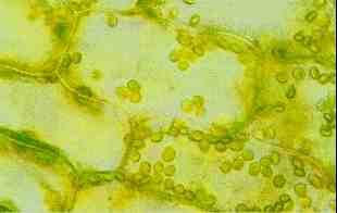 Chloroplastes dans une feuille d'élodée