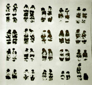 caryotype de souris